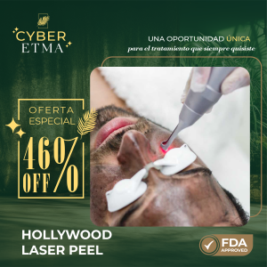 Hollywood láser Peel