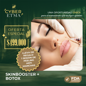 Skinbooster + Botox